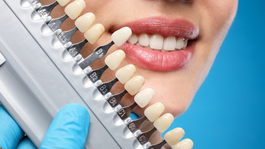 Top 5 Cosmetic Dentistry Procedures at the Best Dental Clinic in Noida