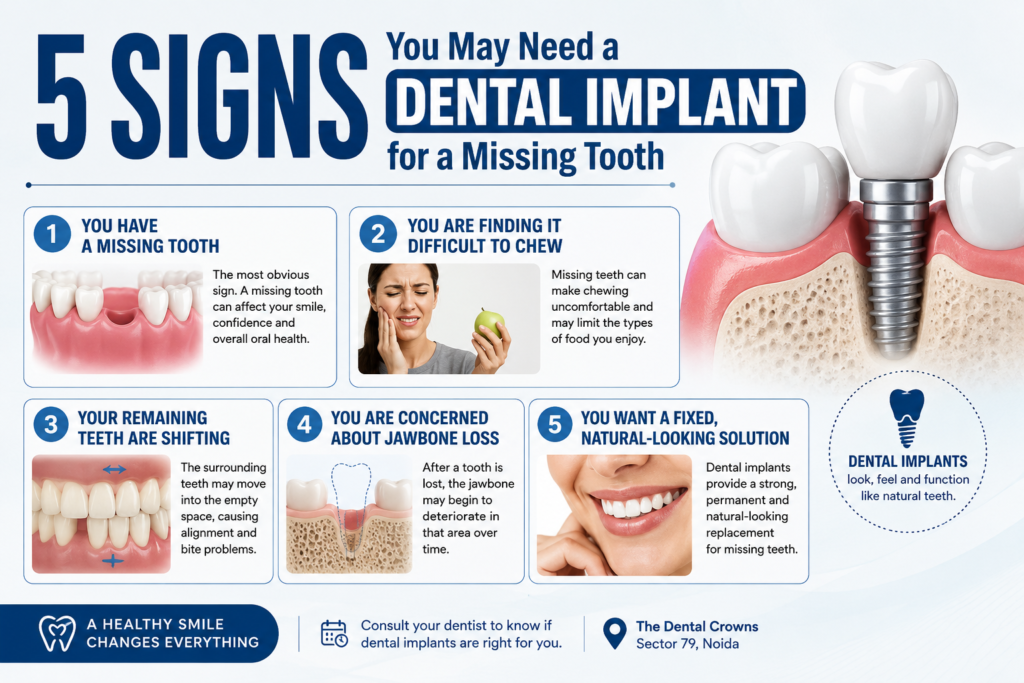 dental implant for a missing tooth