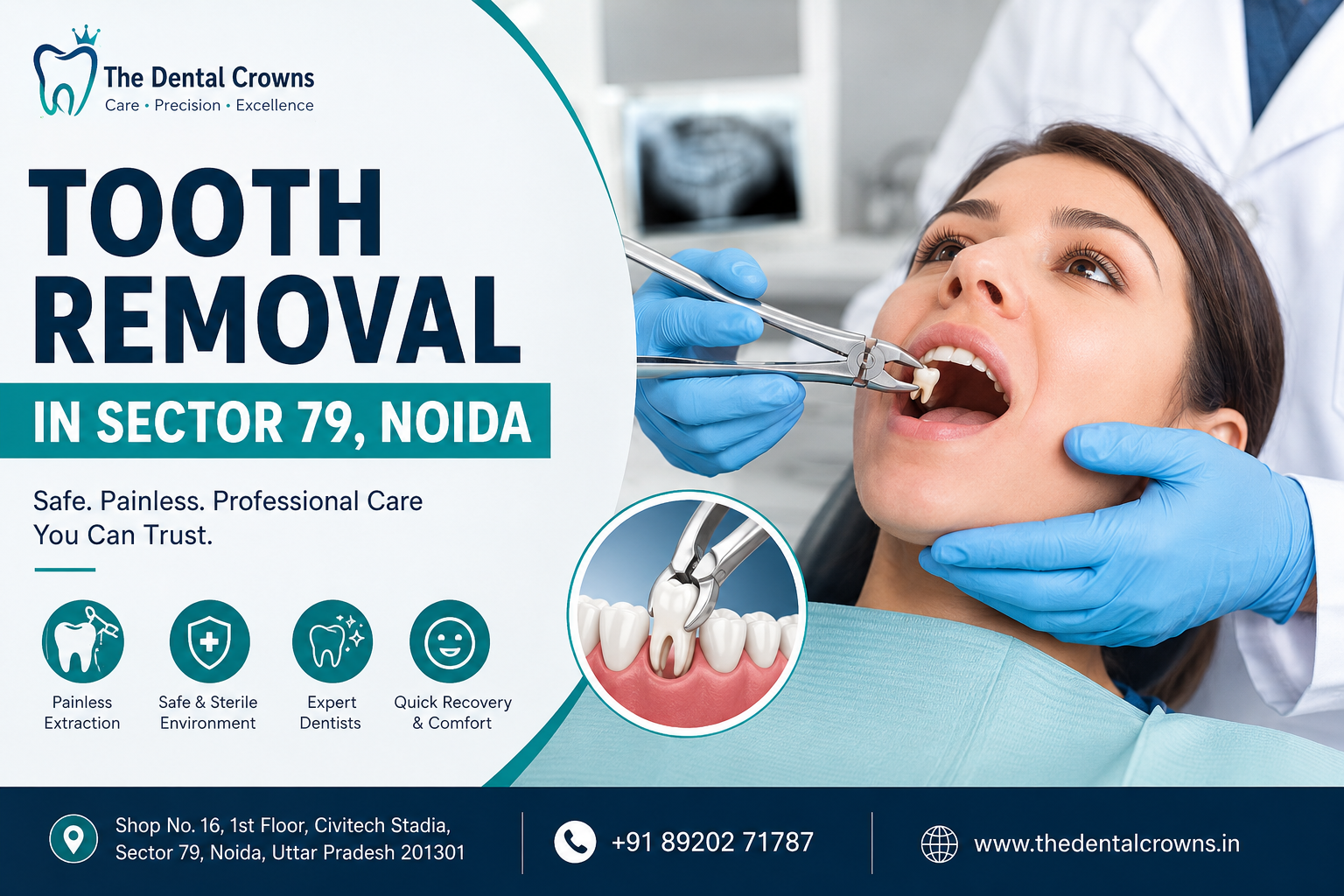 Tooth Removal