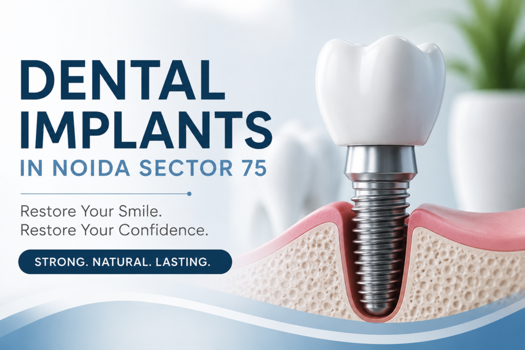 Dental Implants in Noida Sector 75
