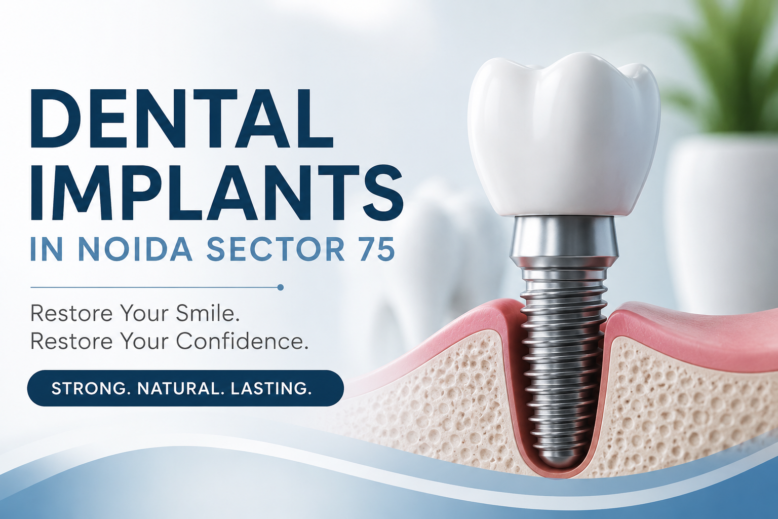 Dental Implants in Noida Sector 75