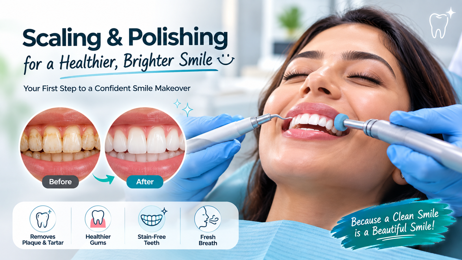 Scaling and Polishing in Sector 76 Noida
