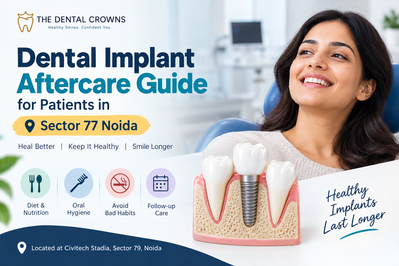 Dental Implant Aftercare Guide for Patients in Sector 77 Noida