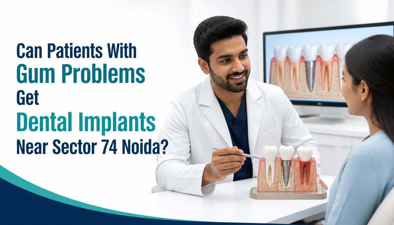 dental implants near Sector 74 Noida